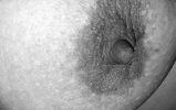 My Nipples