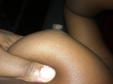 Nipples