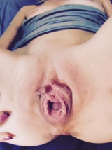 gapping holes