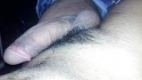 Diversion