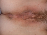 LAURY11