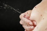 milch titen