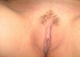 VEGYES