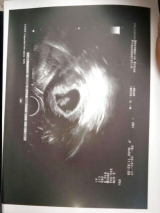 the youngest breeder ...