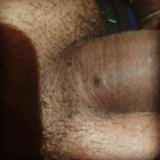The mole