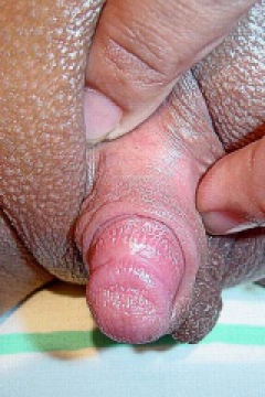 Big clit - N