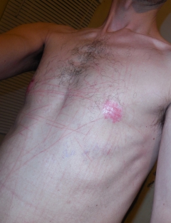 My tits in pain (nipples removed) - N