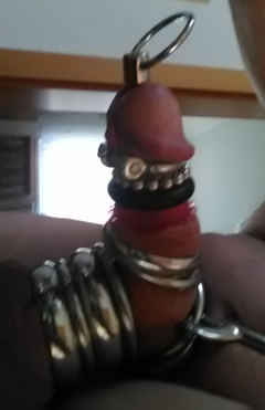 urethra sounding - N